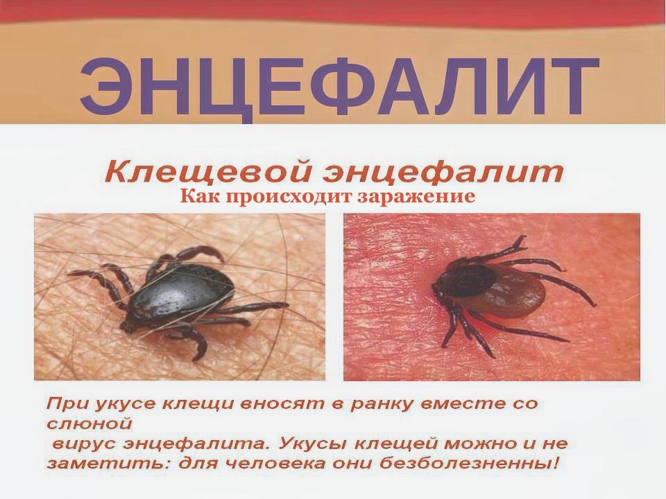 Клещевой энцефалит – симптомы и как происходит заражение Клещевой энцефалит – симптомы и как происходит заражение